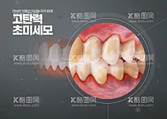 洗牙海报  - 源文件下载【酷图网】医疗,洗牙,素材,牙科,牙菌斑,牙垢,口腔,清洁,牙膏,刷牙,牙齿,广告,宣传,牙刷,海报,PSD,设计,模板,医美