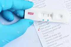 采用快速检测盒检测RSV阳性结果