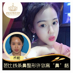 年轻时的无华采集到案例