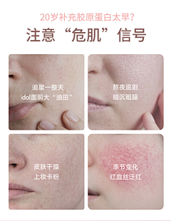 ngclf采集到痛点