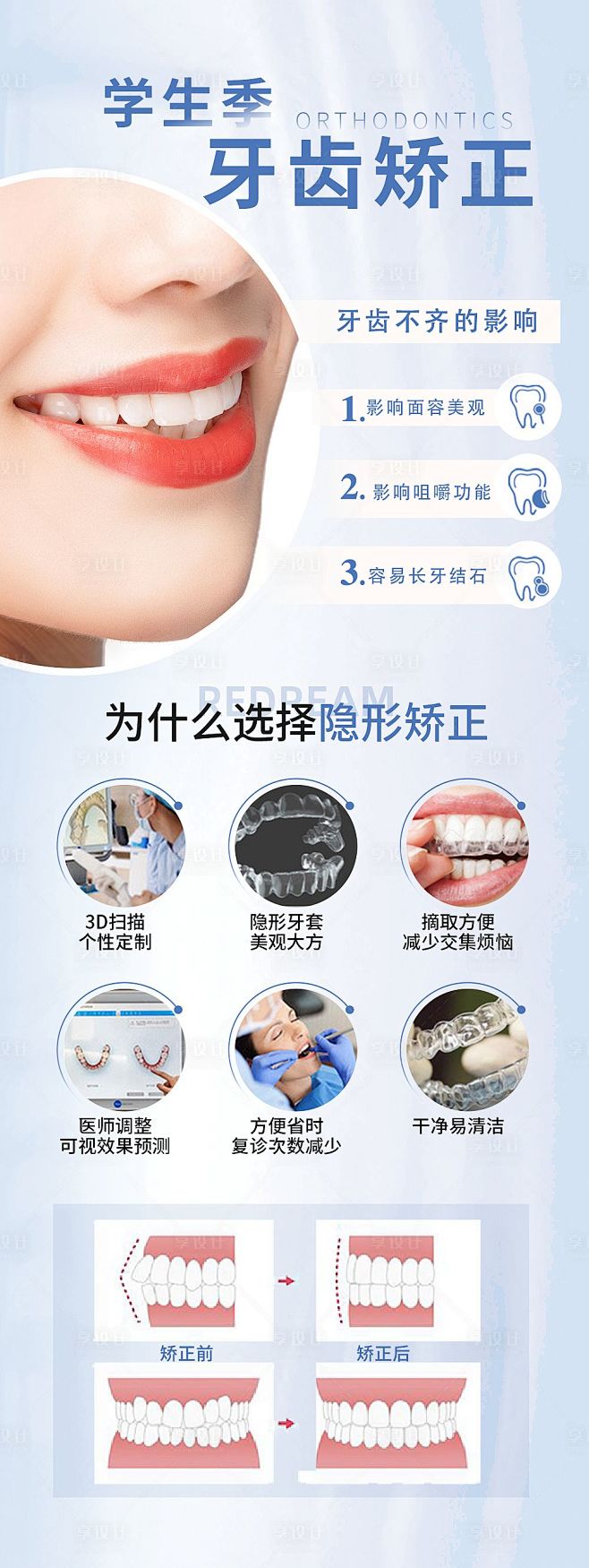 牙齿矫正海报-源文件