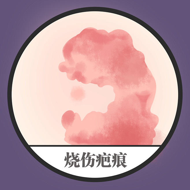疤痕 疤痕消除 疤痕体质 疤痕增生如何消...