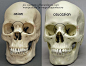 Asian and Caucasian skull