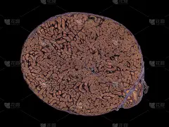 睾丸精子发生-显微镜下横切面-暗视野