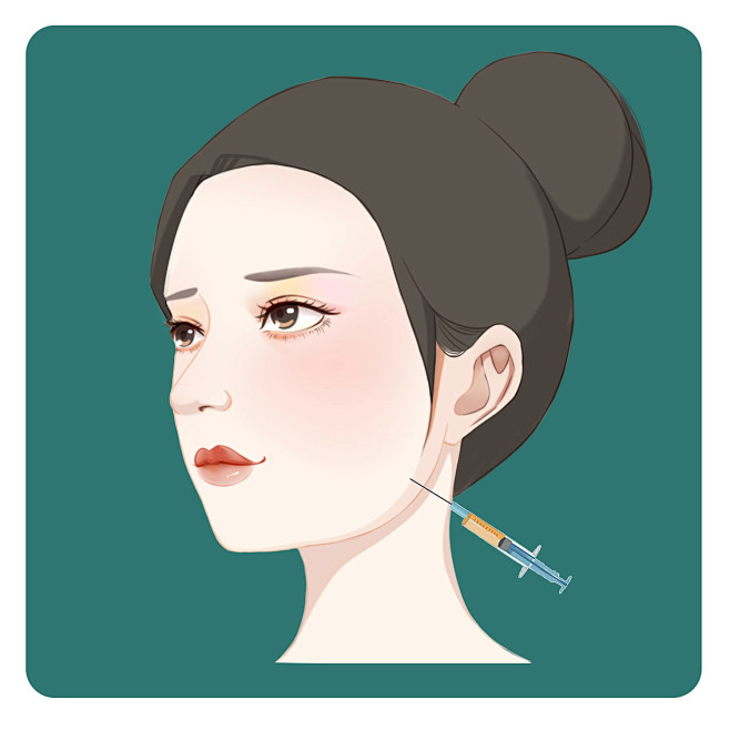 玻尿酸 玻尿酸手术 卡通 漫画 插画 医...