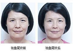 晚了很久采集到案例