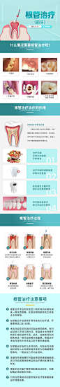 根管治疗详情页-源文件