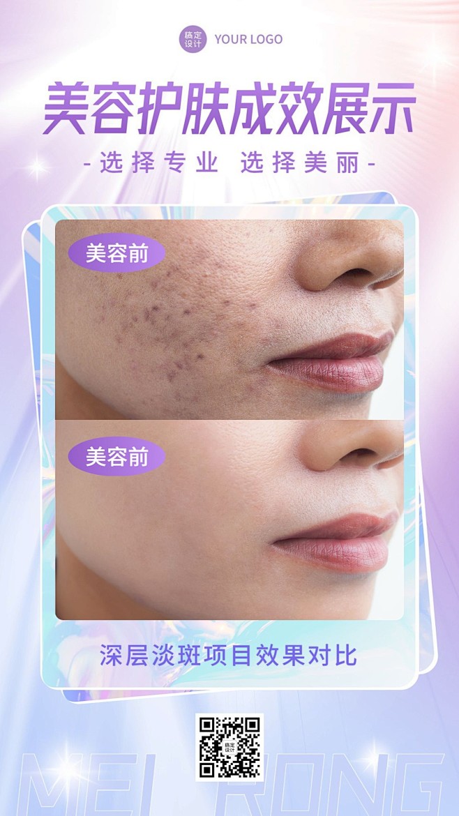 美业美容护肤效果展示前后对比图简约手机海...