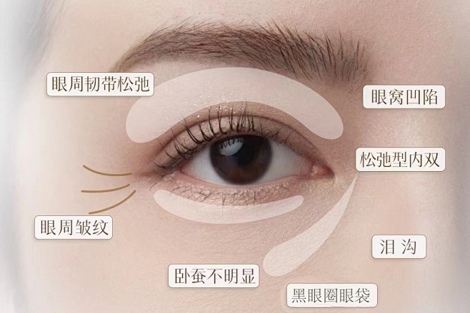 眼周常见问题