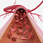 心动脉血管医学插画