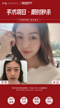 11000+医美整形案例视频-图片#美女模特#高清素材#打包下载