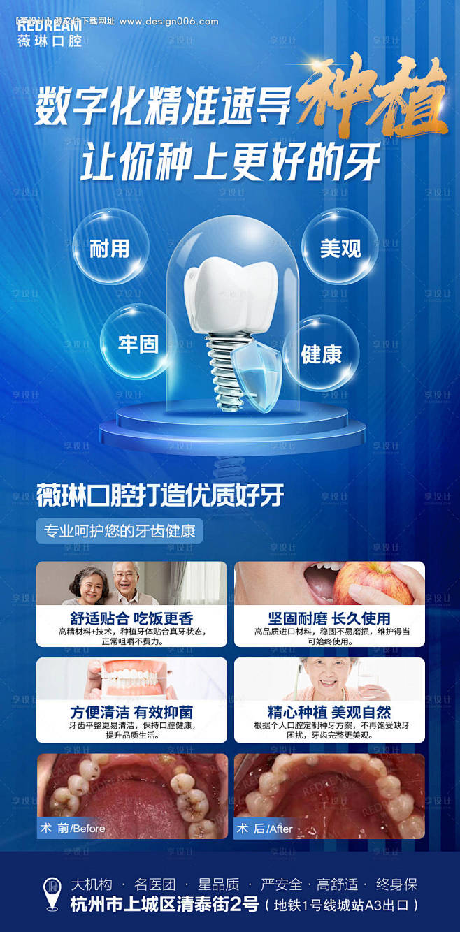口腔种植牙活动海报-源文件【享设计】