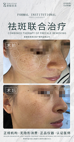 顾屿07采集到案例对比