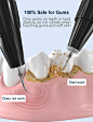 Amazon.com: 牙齿牙菌斑去除器 - 声波电动牙齿清洁器,牙垢微积分牙齿去除器清洁工具套件,适合成人儿童: Beauty