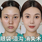 O1CN01zYimBc23x4NQ7J6pp_!!0-item_pic