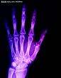 X光 手骨 医疗 科技卫生