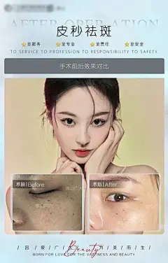 【南门网】 海报 医美 美容 整形 皮秒 祛斑 案例 对比 人物 464100
