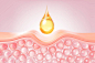 Cosmetic serum Oil drop on Saggy skin cell, Skin Repair, moisturizer, collagen serum, advertising background ready to use, 3D rendering圖像檔