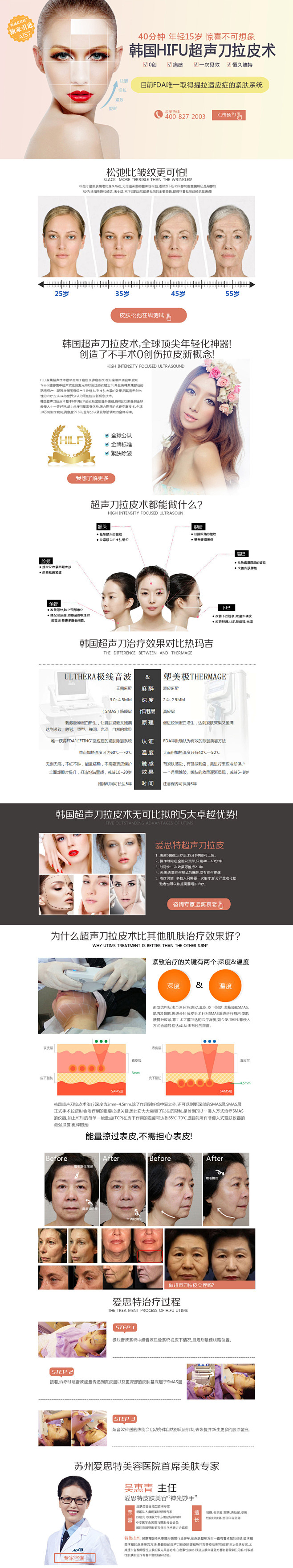 超声刀_秀作品_王璐璐主页_我的联盟