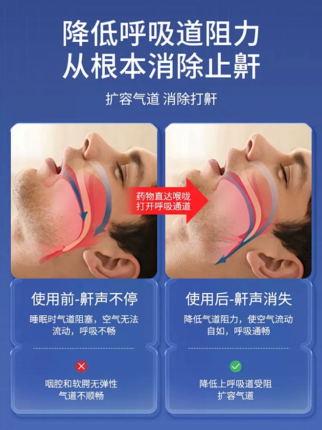 液体止鼾神器打呼噜防呼噜消男士女打鼾器贴...