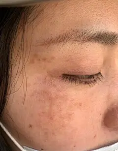 【仁和匠心仁和匠心祛斑套装】仁和匠心 美白祛斑霜去雀斑黄褐斑老年斑精华霜 淡化斑黑色素美白精华液男女士保湿面霜护肤品 祛斑套装【行情 报价 价格 评测】-京东