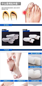 硅胶拇指外翻器矫正外八字脚趾大脚拇指外翻女鞋垫柔软舒适足外翻-tmall.com天猫