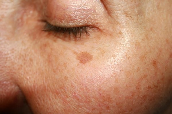 04_skin_Skin-Care-In...