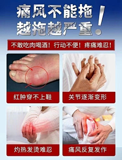小阳、采集到A-痛风-参考