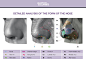 Analysis of the nose