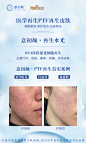 抗衰案例海报-素材库-sucai1.cn