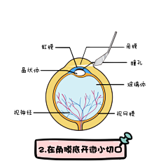 逃太郎采集到眼科