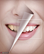 创意合成牙齿美容美白对比医美海报海报招贴素材下载-优图网-UPPSD