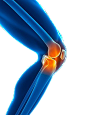 膝盖痛png (3)