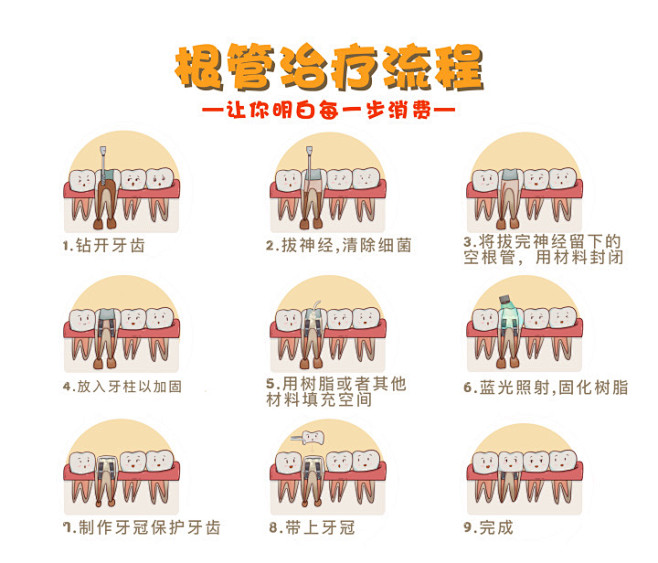 根管治疗，口腔，牙齿，医疗 治疗过程_刘...