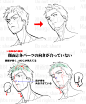 集