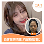 面部整形医美整形案例
