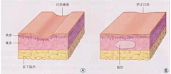 o4OjqZrE采集到医美素材