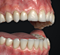 Teeth Asset, Fareed Nagy : I built a new and improved set of teeth that is now available for sale here on Artstation! Film and Real-time versions available separately. 

https://artstn.co/m/jKYd

https://artstn.co/m/oR6m


VFX Asset Includes:  
.FBX Mesh 