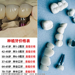 善逸1107采集到口腔种植牙拼图四宫格九宫格信息流
