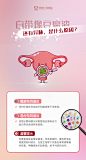 妇科-(15)贵阳
