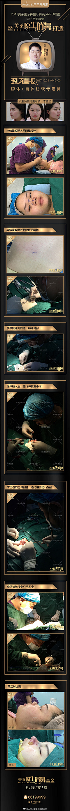 墨_兰采集到鼻整形