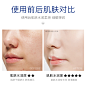 百瑟护肤品水乳面部护理套装补水保湿烟酰胺玻尿酸正品-tmall.com天猫