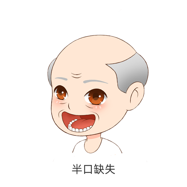 牙齿缺失人物（男）-半口牙缺失