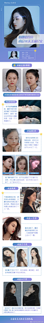 #美天真人秀#
给大家分享一位
肋骨鼻综合美女的美鼻恢复日记
从容貌到气质焕然一新
@综合鼻修复医生董宏华
石家庄整形超话#鼻整形##石家庄整形# 2石家庄·星源美天医疗美容医院 ​​​​