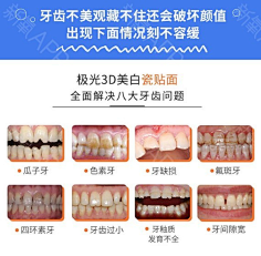 全瓷牙贴面：重塑笑容的秘密武器