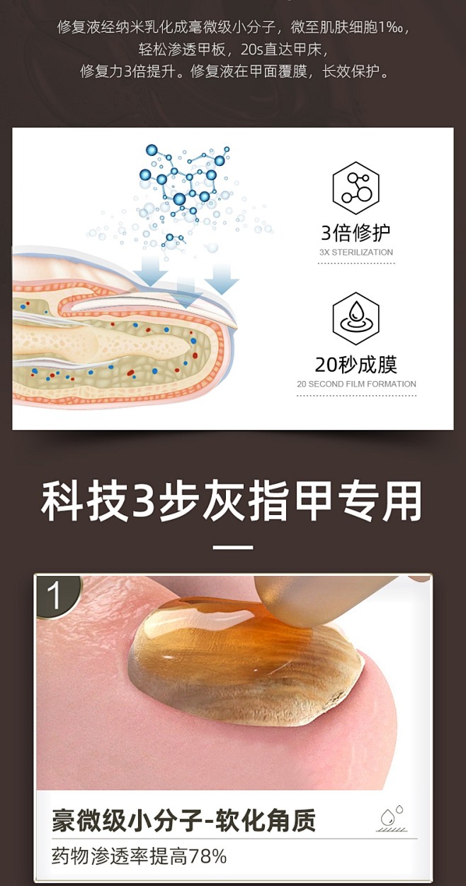 【自营】灰指甲特效药水治疗专用药甲沟炎冰...