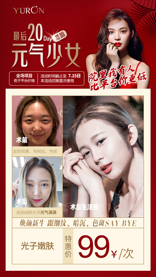整形 活动