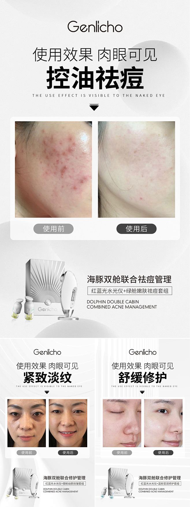 医美案例对比海报