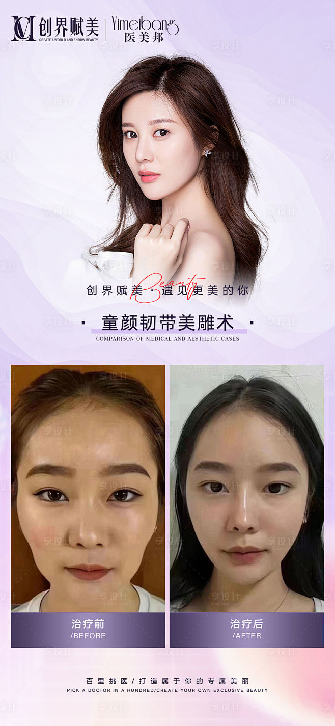 医美抗衰案例分享海报-源文件