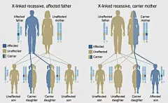血友病—欧洲皇室贵族诅咒？从维多利亚女王开始的“遗传病噩梦”|出血|携带者|治疗_网易订阅